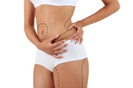 Erimeyen yağlarınızdan liposuction ile kurtulun