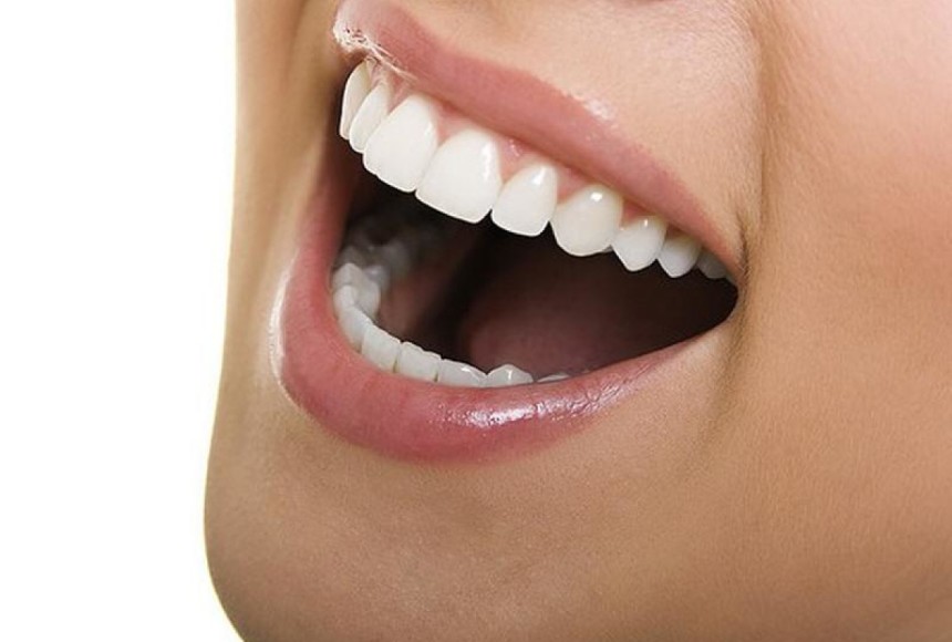 Lingual ortodonti ile diş teli takma kâbusu sona eriyor